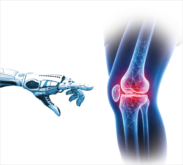 Robot-Assisted Joint Replacement