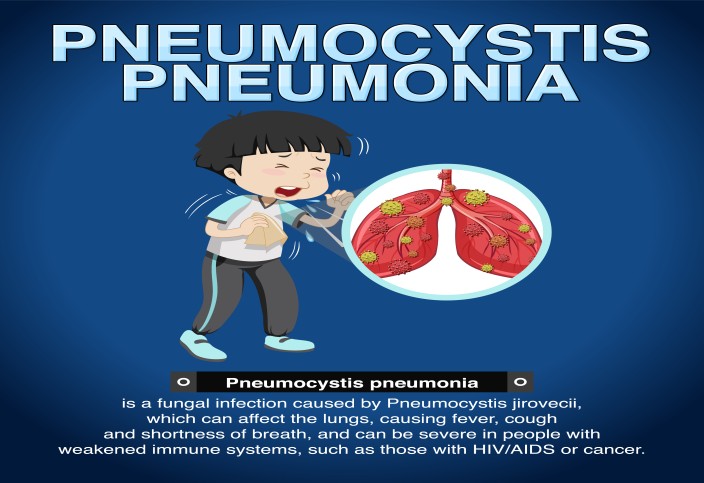 Pneumonia in Children